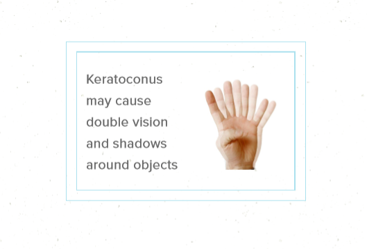 Keratoconus