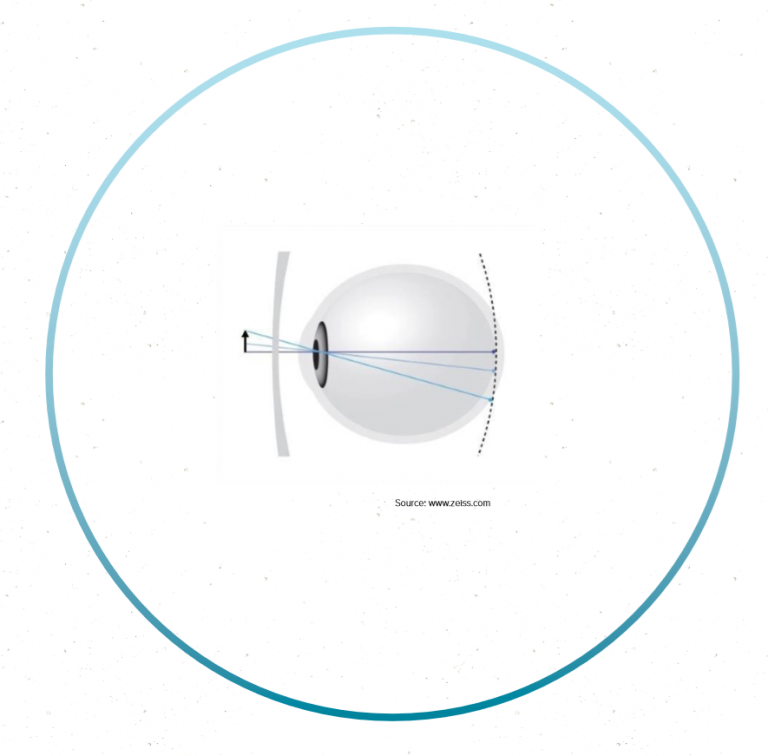 Orthokeratology FAQs Costa Mesa CA Insight Vision Center Optometry