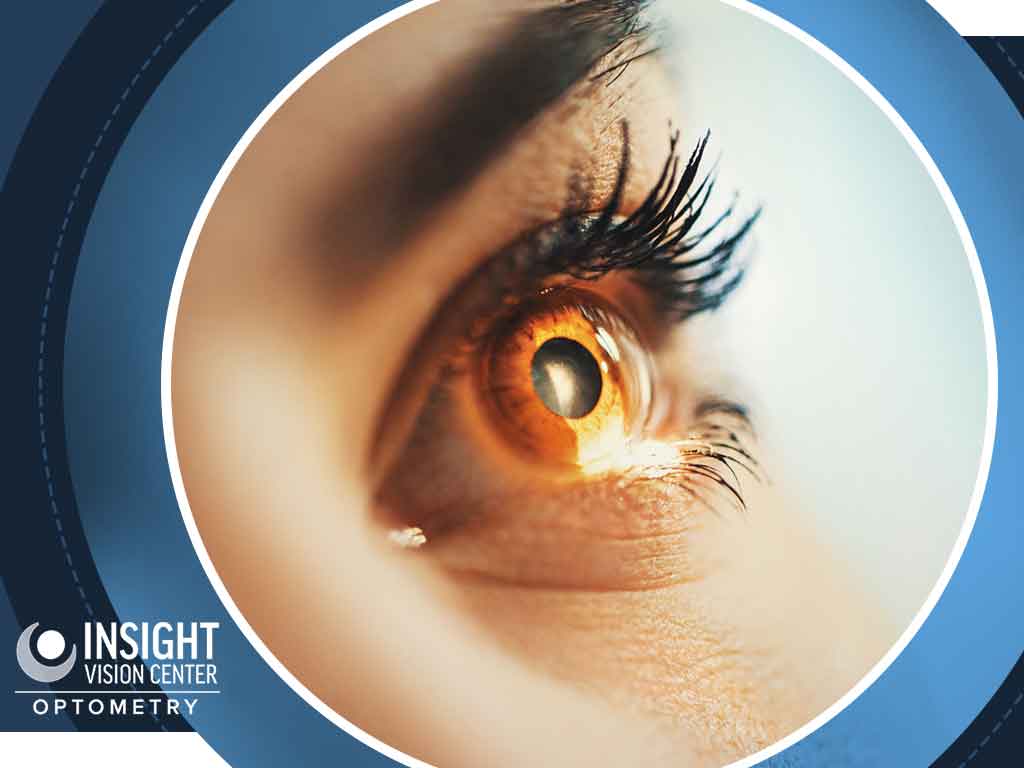 What Is OrthoK, and Who Can Benefit From It?