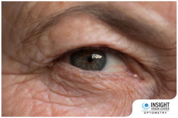 How Vision Problems Lead To Cognitive Decline In Adults