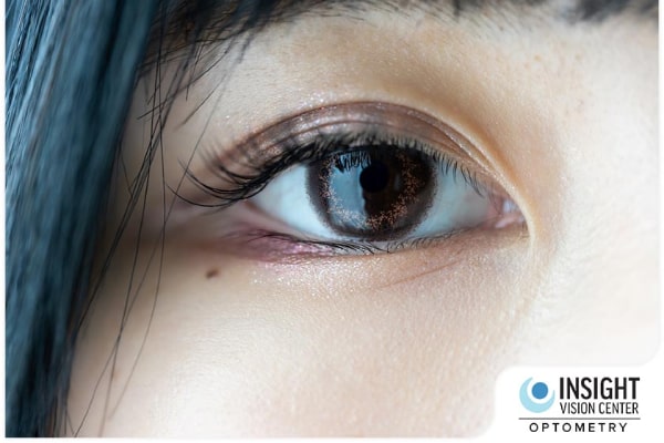 The Consequences Of Contact Lens Overwear