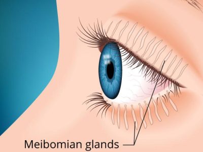 Meibomian Glands 330x287 2x