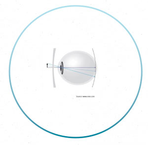 How Do Glasses Correct Myopia How Do Glasses Correct Myopia