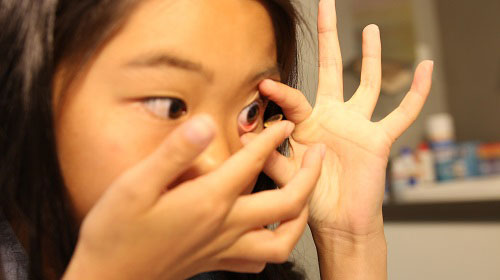 Inserting Orthok Lenses Smaller Inserting Orthok Lenses Smaller