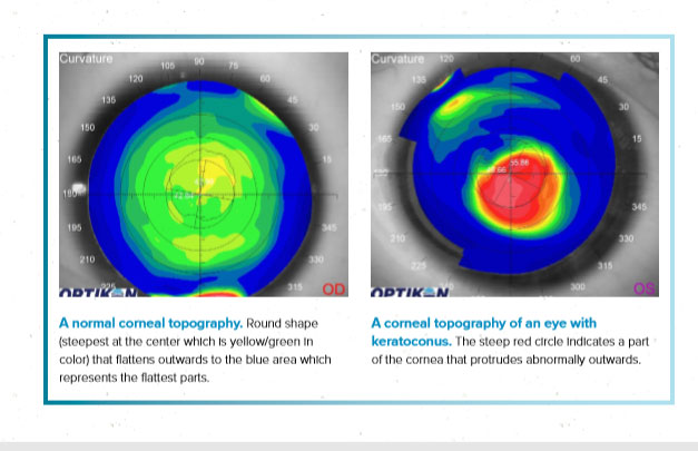 Understanding Topography